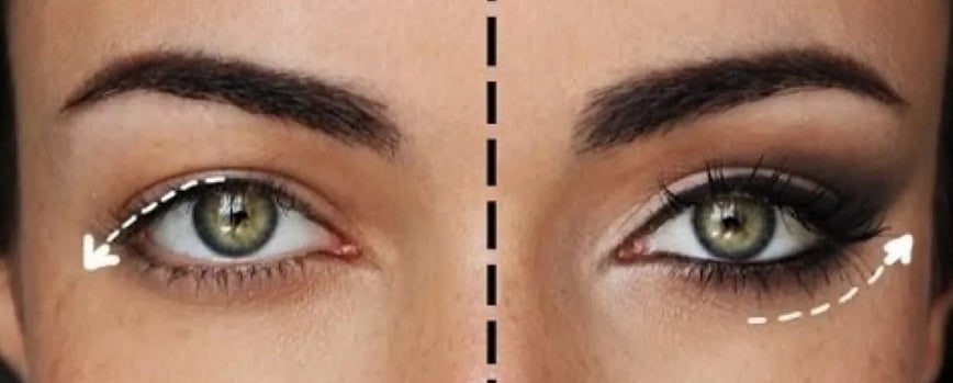 Ojos caídos