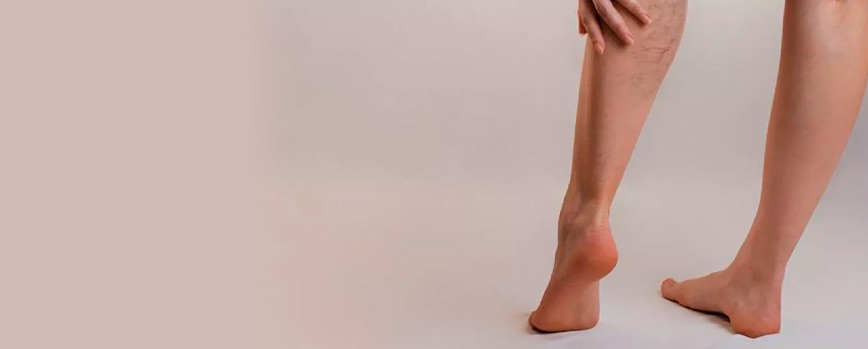 ¿Eres propenso a las venas varicosas? ¡Prueba la caléndula!