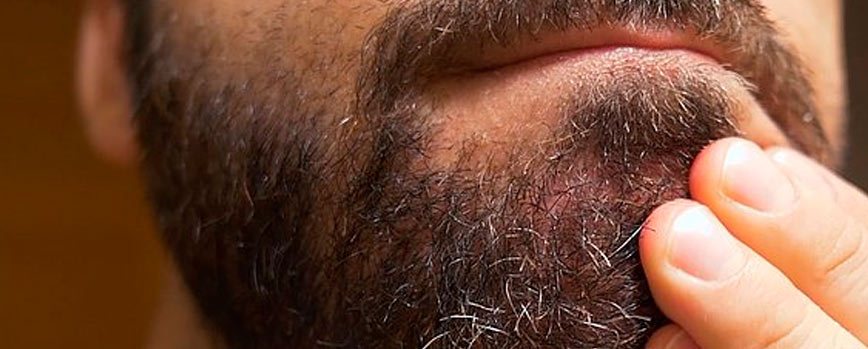 Causas de la dermatitis seborreica