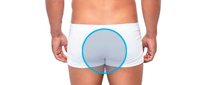 Depilación perianal hombre